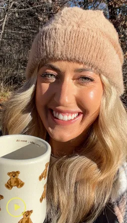 Real Smile Express overviewing Smile Express aligner process