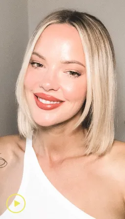 Real Smile Express Invisalign aligner patient starting treatment at Whitlock Orthodontics